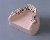 Gesso de Dentista Tipo IV Novadur 6Kg